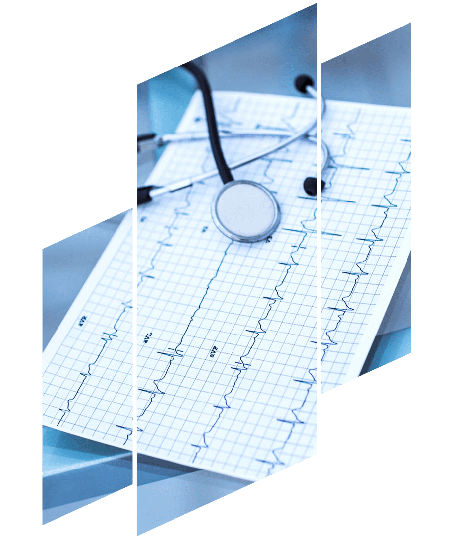 electrocardiograma-en-merida.png