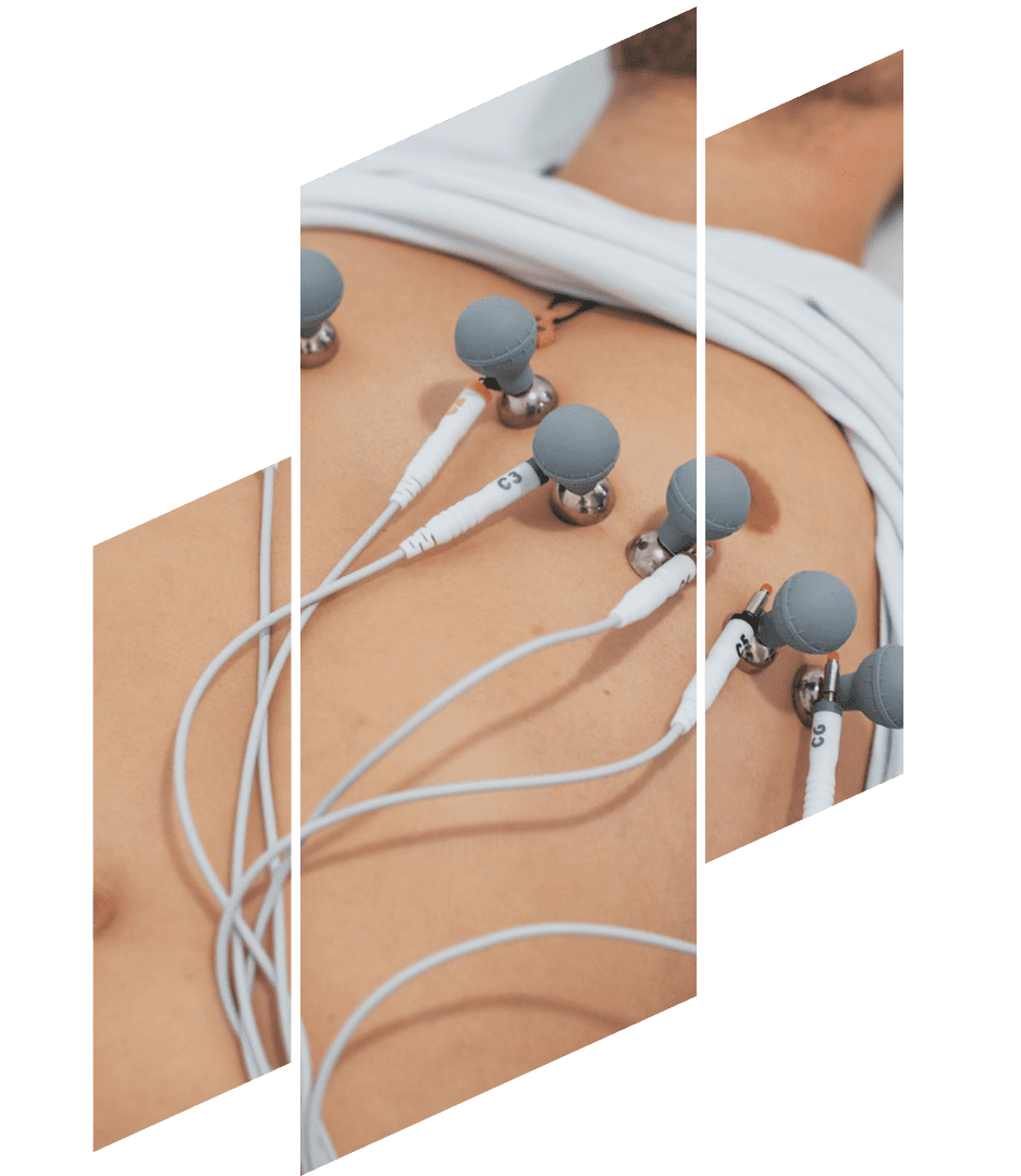 precio-de-estudio-de-ekg.png